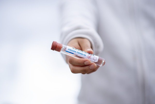 «Инвитро» запускает количественное тестирование на антитела к коронавирусу