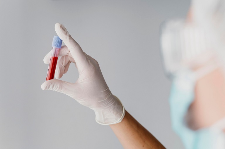 Диагностика туберкулёза у детей: учёные предложили новый тест по образцу крови из пальца