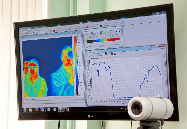 Медицинская термография презентация